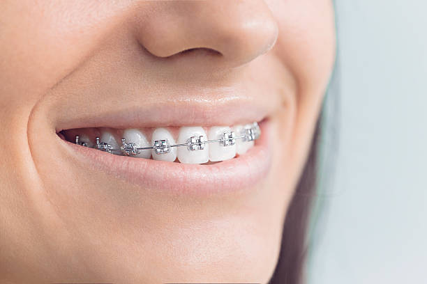 TMJ/TMD Treatment in Bloomington, IL